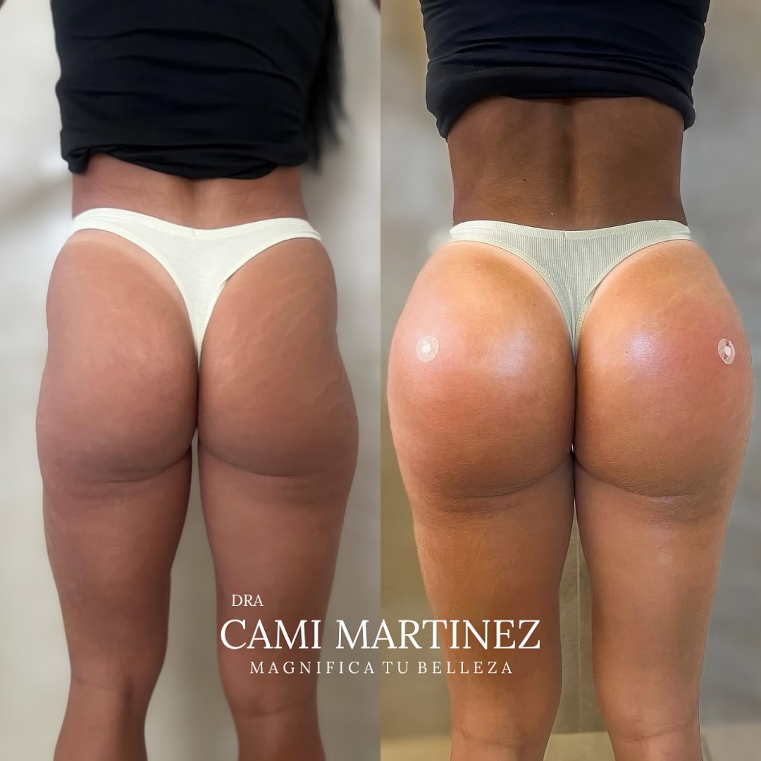 Maria Camila Martinez Facebook ad: ¿Lista para unas curvas que dejan huella en…