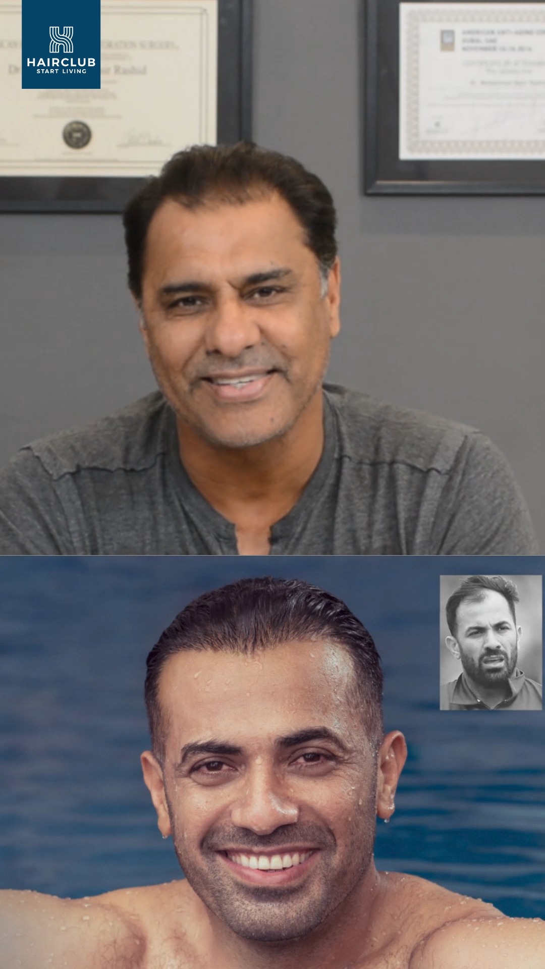 Hair Club Facebook ad: World Class Hair Transplant by Dr. Nasir Rashid