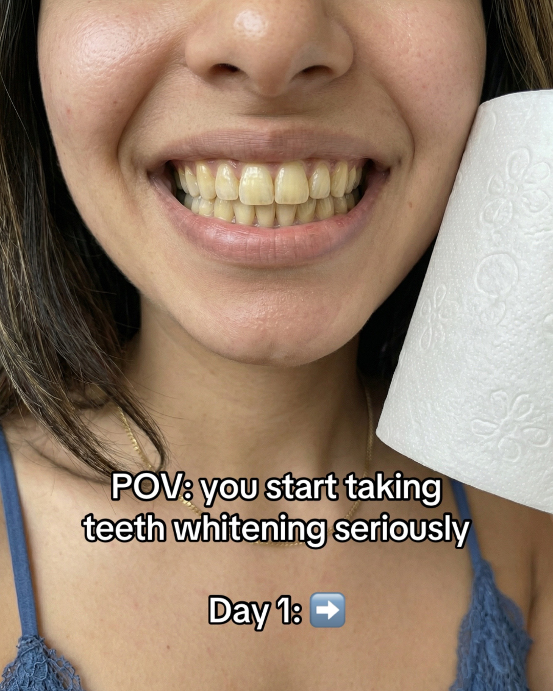 Sophia Flores Facebook ad: Whiter Teeth Now