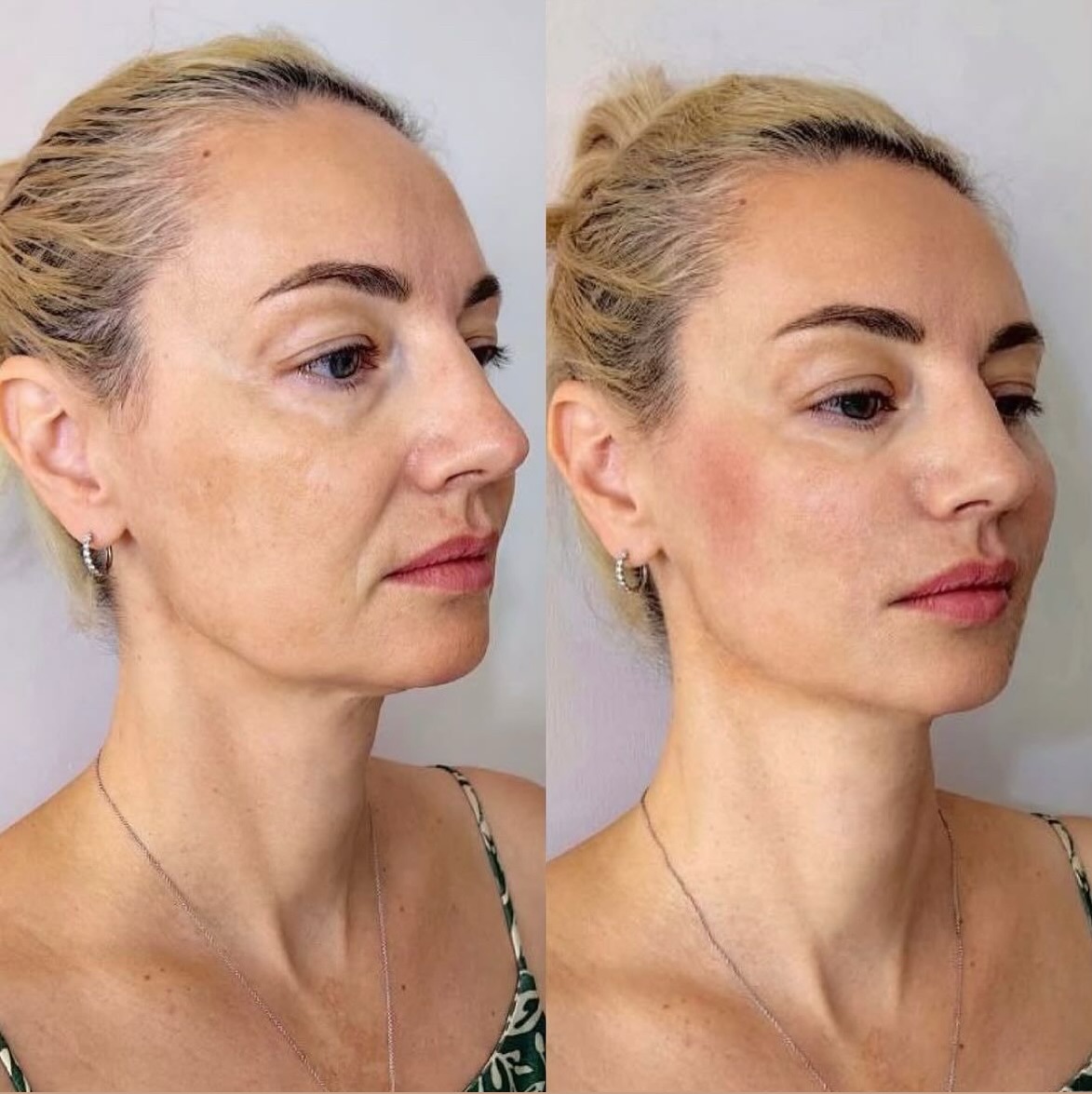 ViVi Clinic Facebook ad
