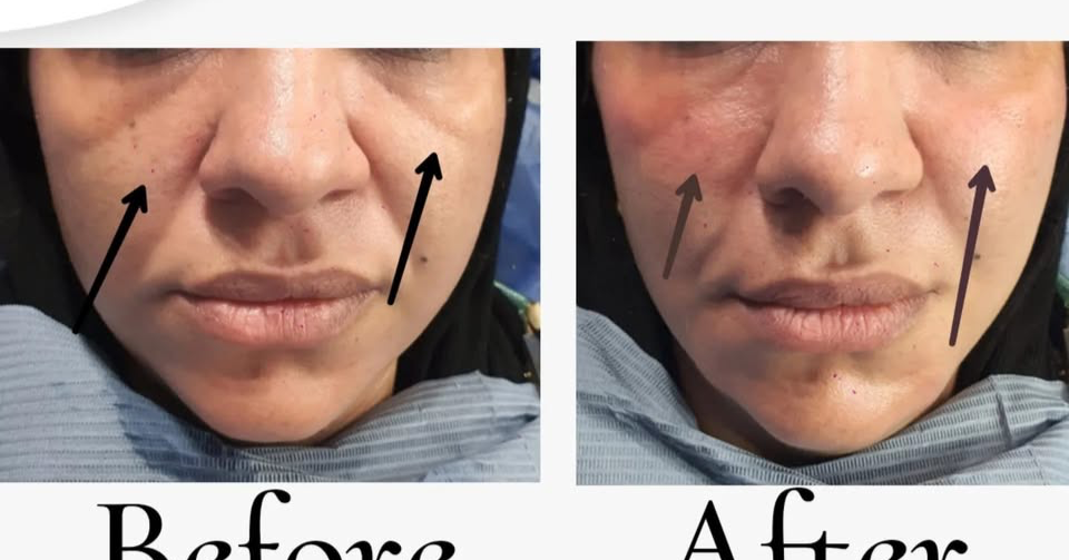Magic skin clinics Facebook ad