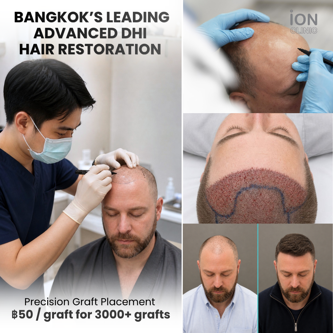ION Clinic Bangkok Facebook ad