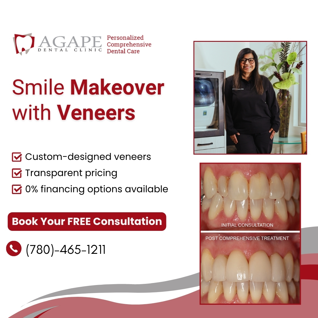 Agape Dental Clinic Millwoods Facebook ad