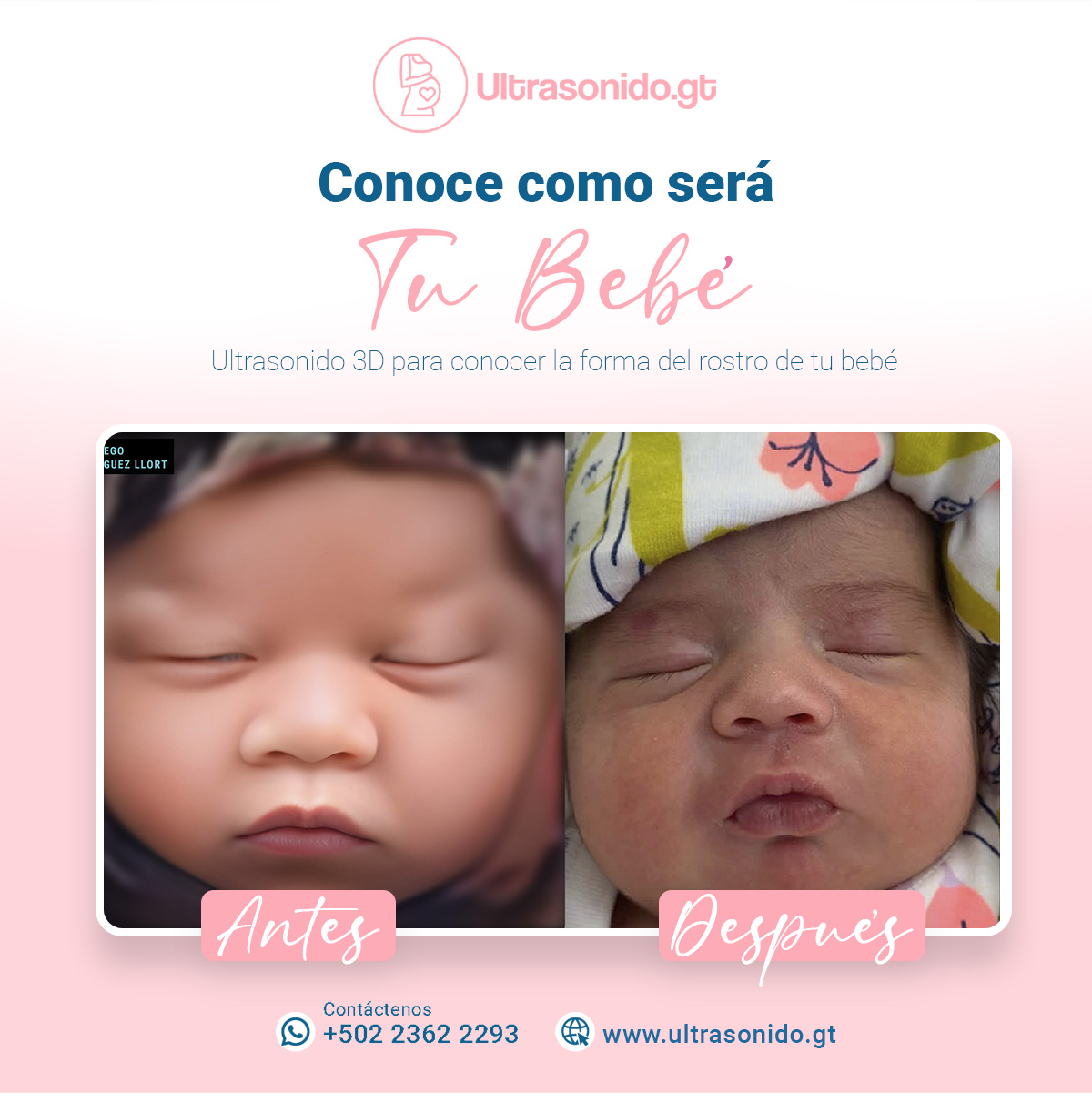 Ultrasonido Gt Facebook ad: Ultrasonido 2, 3, 4, 5D y Ultra HD