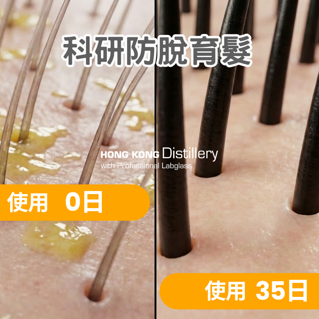 香港蒸餾所 Hong Kong Distillery Facebook ad: 【實測35日見證生機 】洗頭同時育髮!香港科研「啤酒花 x 咖啡因」防脫組合