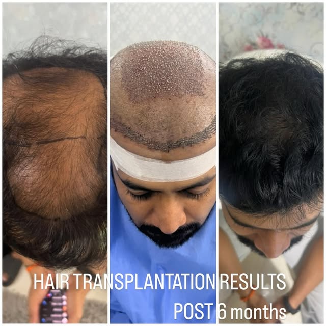 Transformance Facebook ad: BEST OFFERS FOR HAIR TREATMENTS
