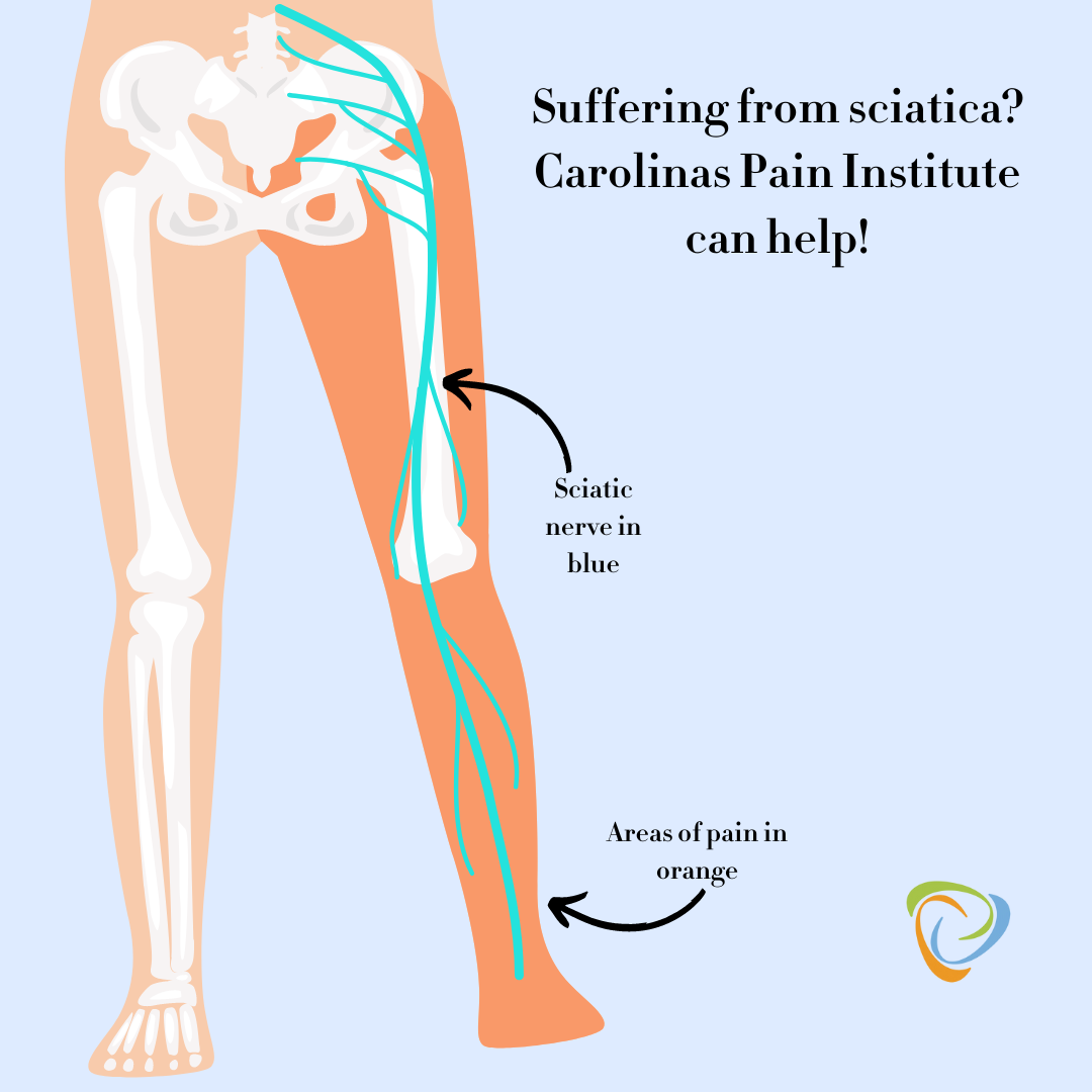Carolinas Pain Institute Facebook ad