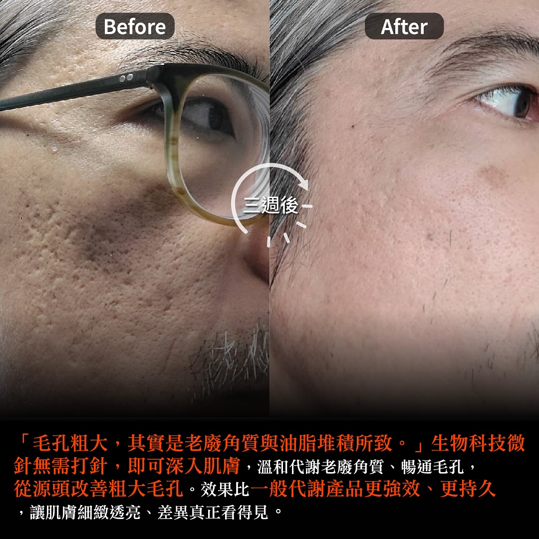 里琪NI-KIYO Facebook ad: 抽獎文
