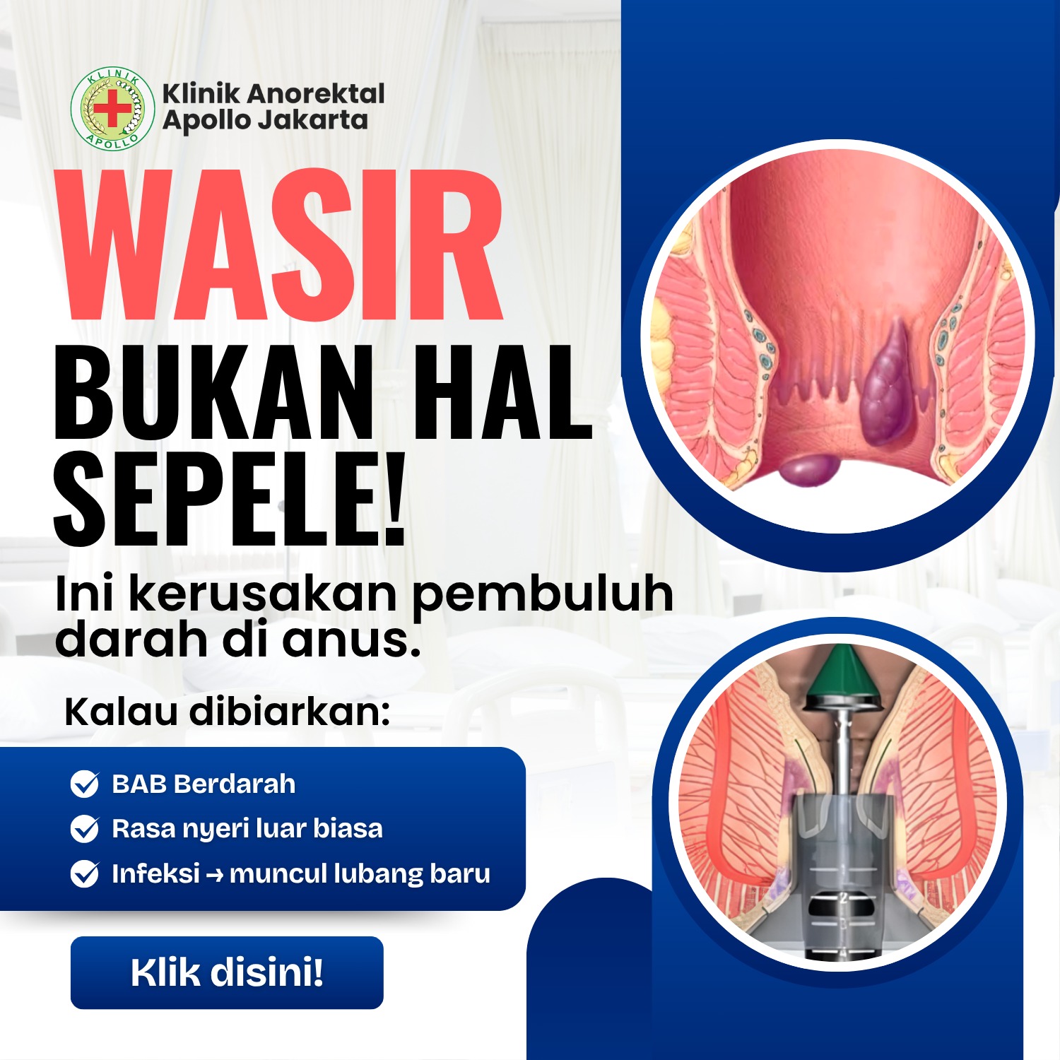Klinik Ambeien di Jakarta Facebook ad: ๐๐จ๐ง๐ฌ๐ฎ๐ฅ๐ญ๐๐ฌ๐ข ๐๐๐๐๐๐ ๐๐๐ฃ๐๐ฅ๐ ๐๐ง๐ฎ๐ฌโฆ