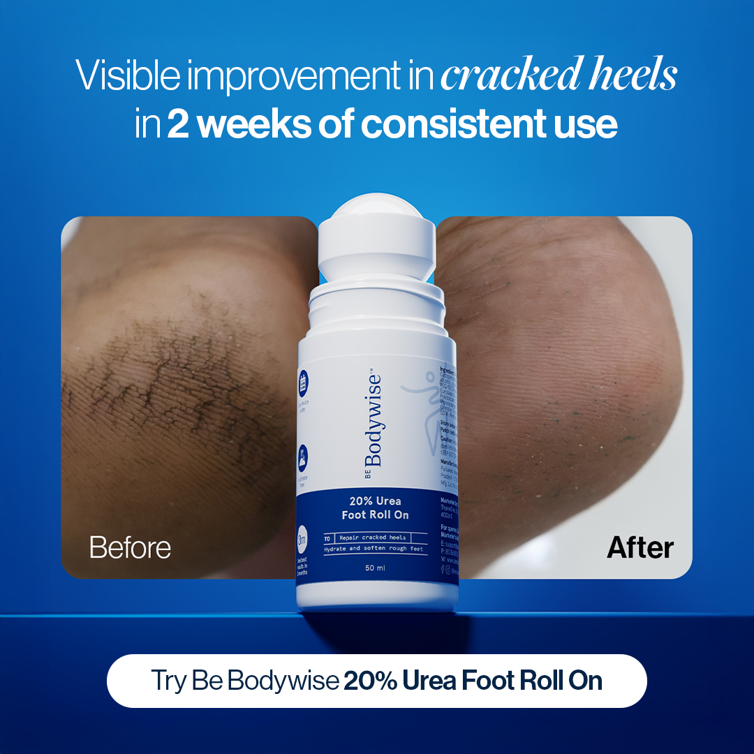 Be_Bodywise Facebook ad