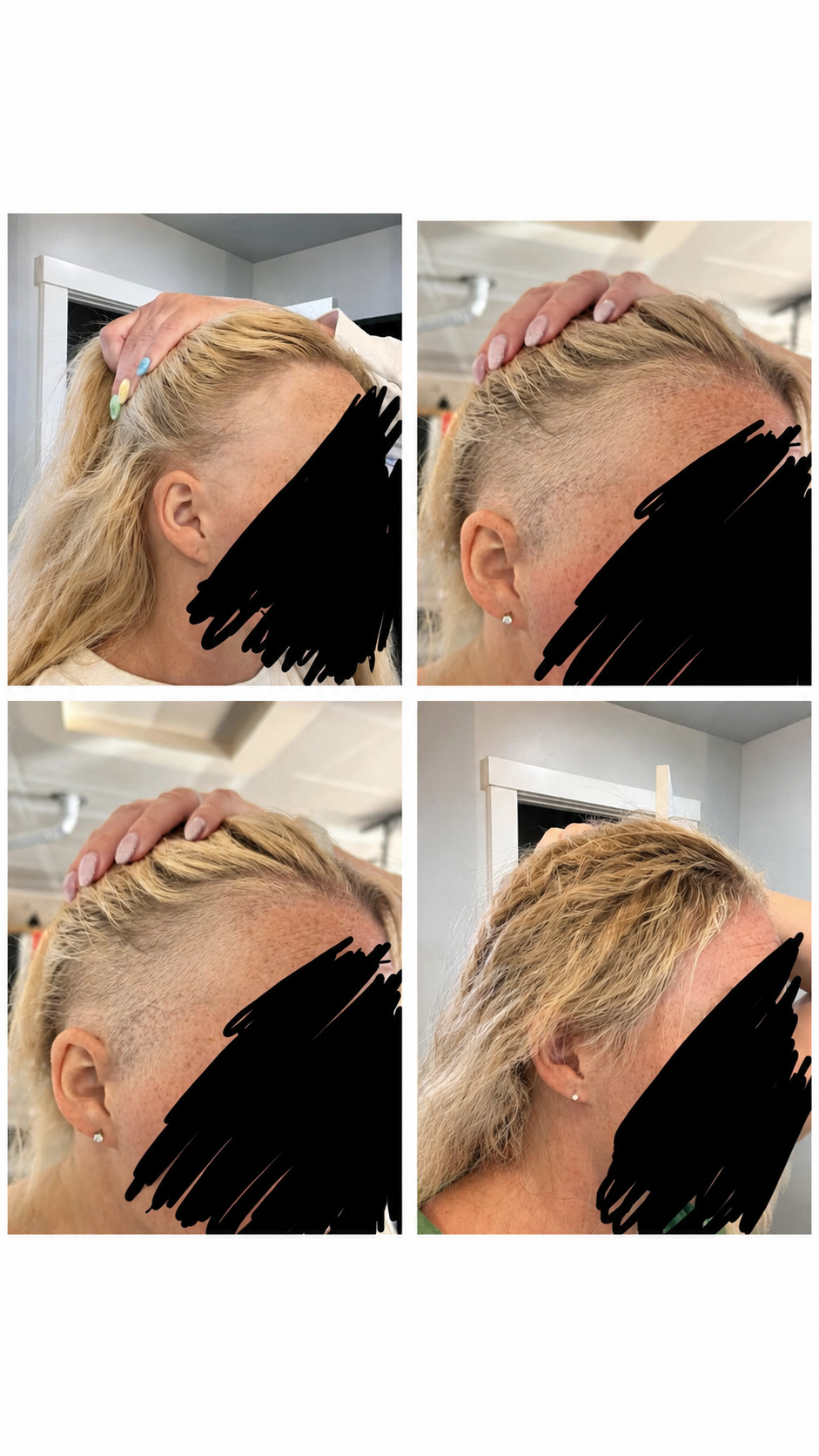 Amina Mitchell Facebook ad: Stop Hair Loss →