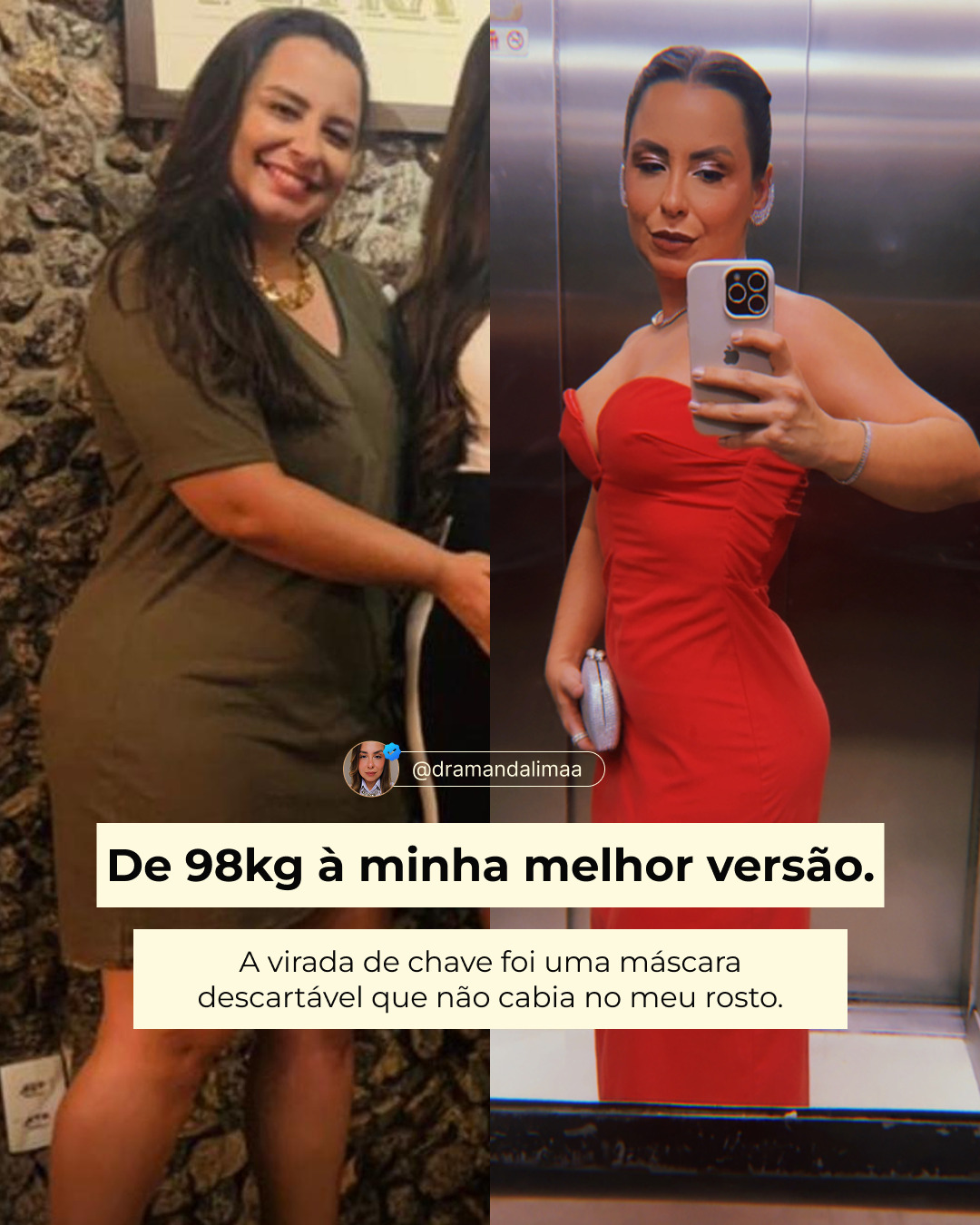 Dra. Amanda Lima Facebook ad: Minha história com a balança não é linear.