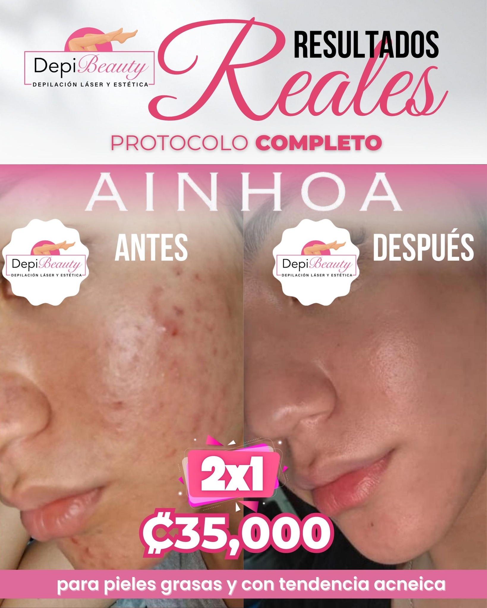 DepiBeauty Depilación Láser y Estética Facebook ad