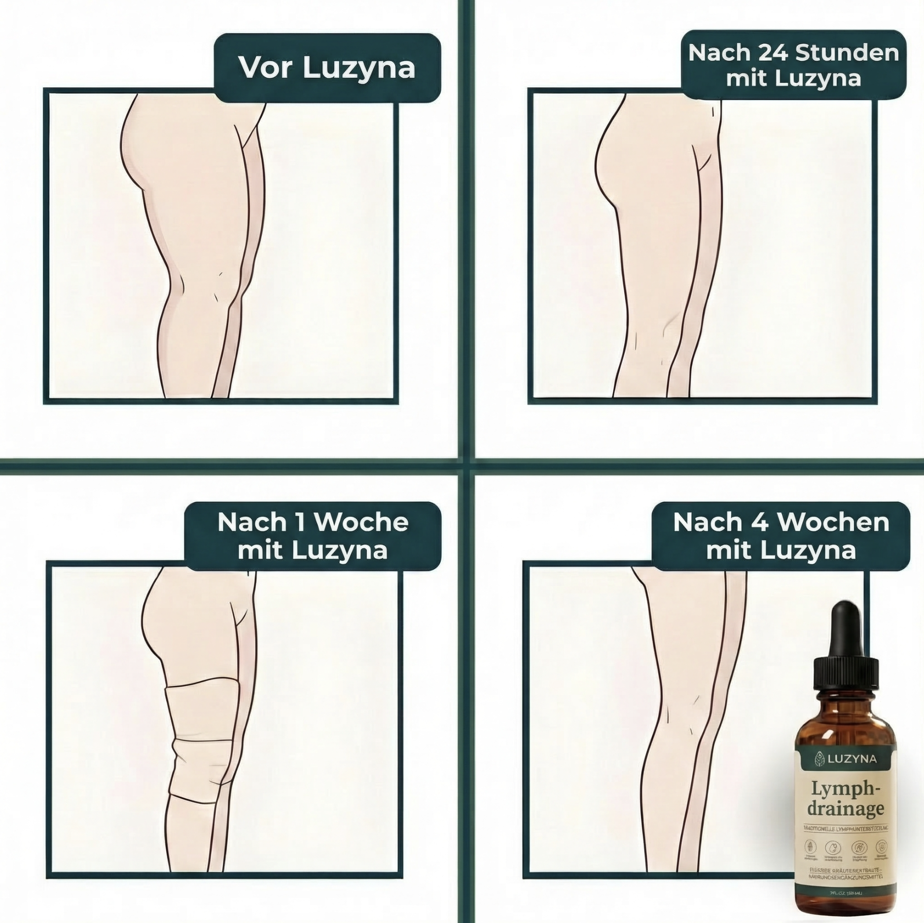 Luzyna Deutschland Facebook ad: Kein Fett. Ihr Lymphsystem ist blockiert!