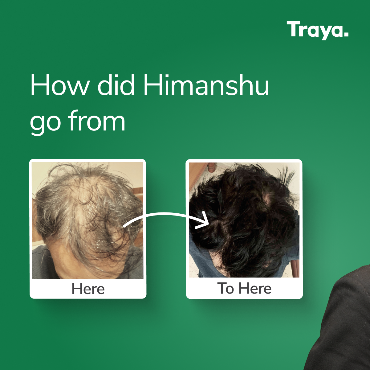 Traya Facebook ad