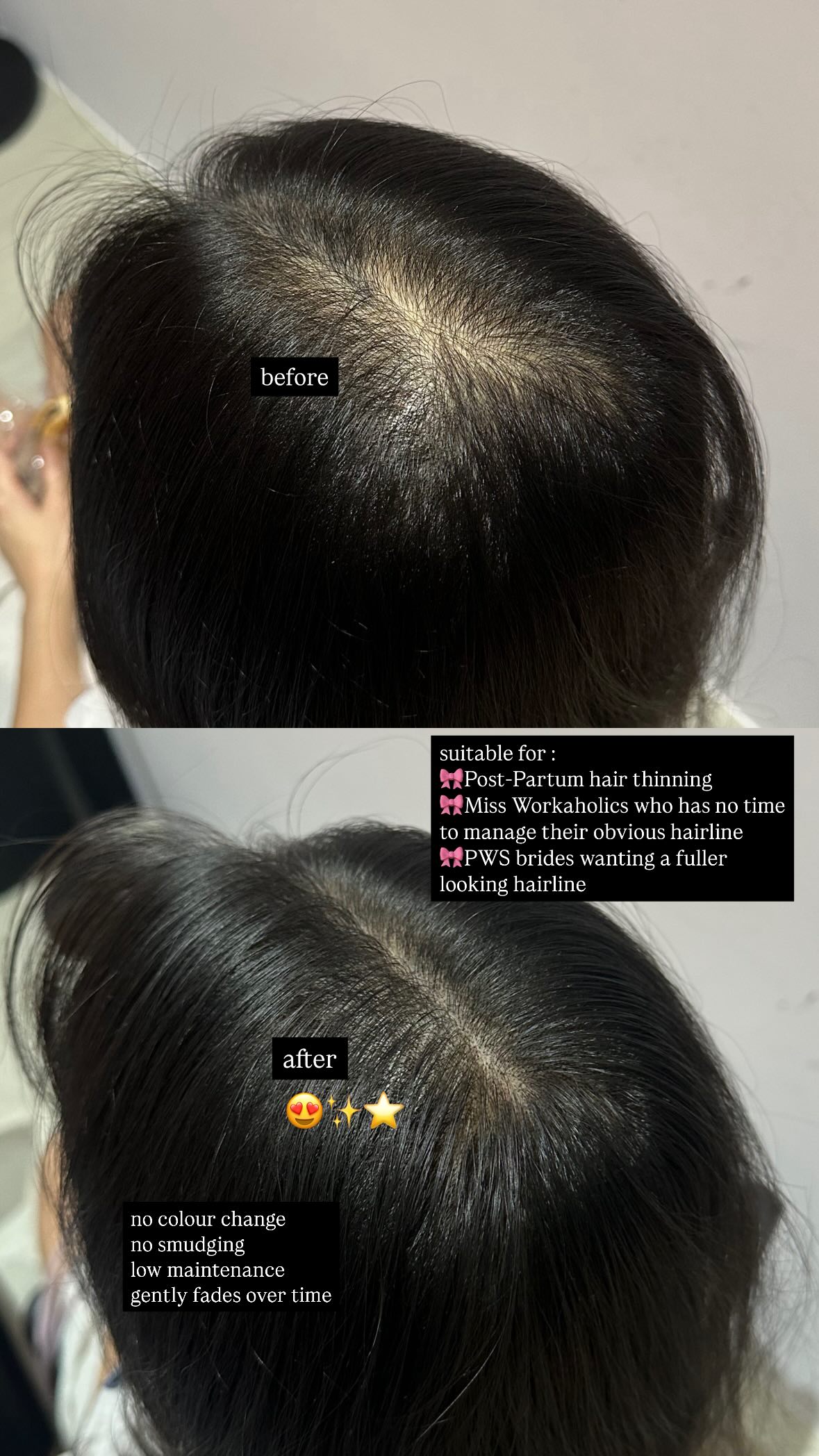 Roots of Majesty Facebook ad: Postpartum hair loss?