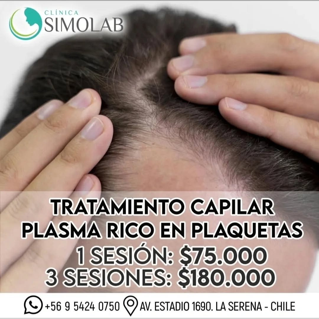 Simolab Clinica Facebook ad