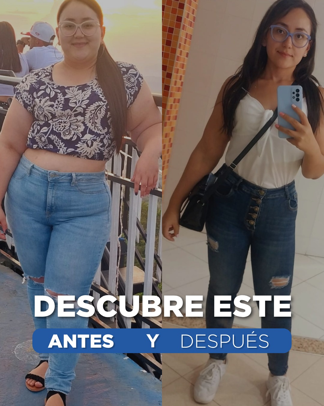Clínica de la Obesidad Facebook ad: El antes y después de Juliana Arango Londoño…