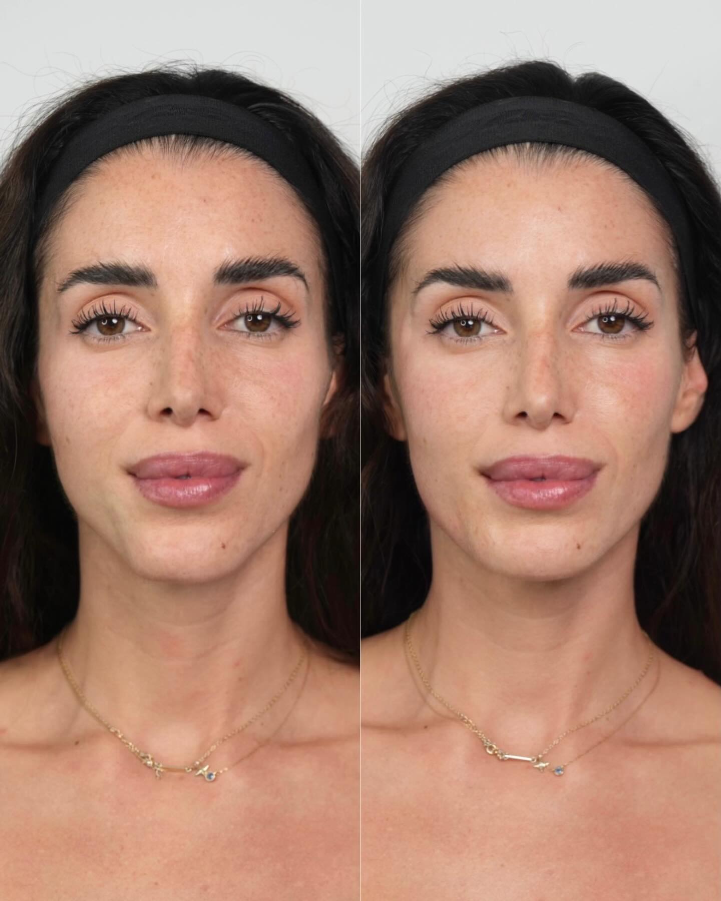 glosclinic Facebook ad