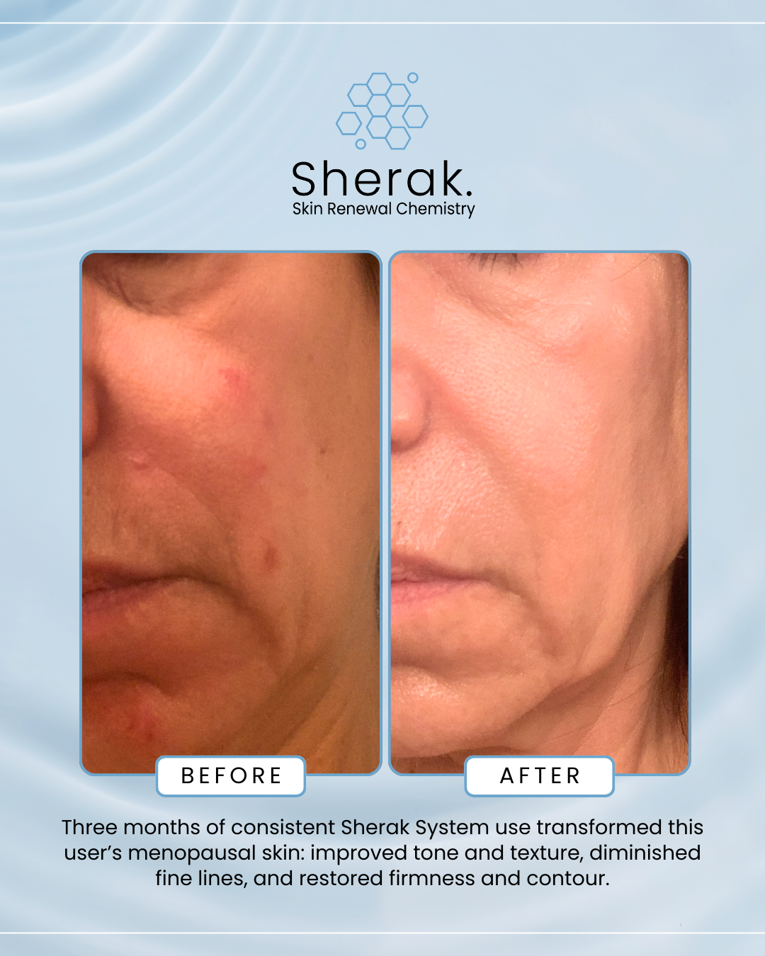 Sherak Skin Facebook ad from Apr 2, 2026