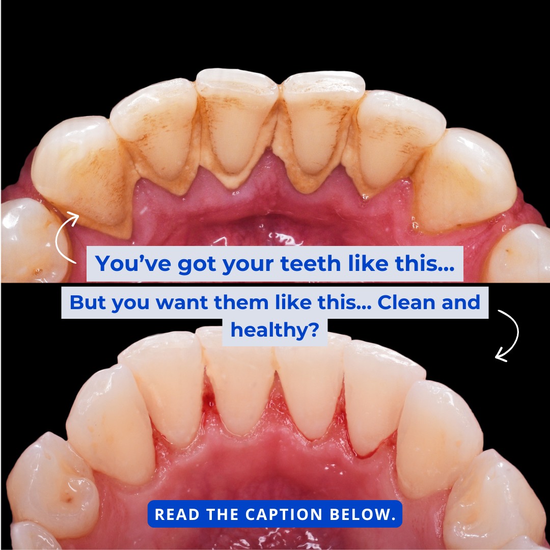Smiles to go Facebook ad