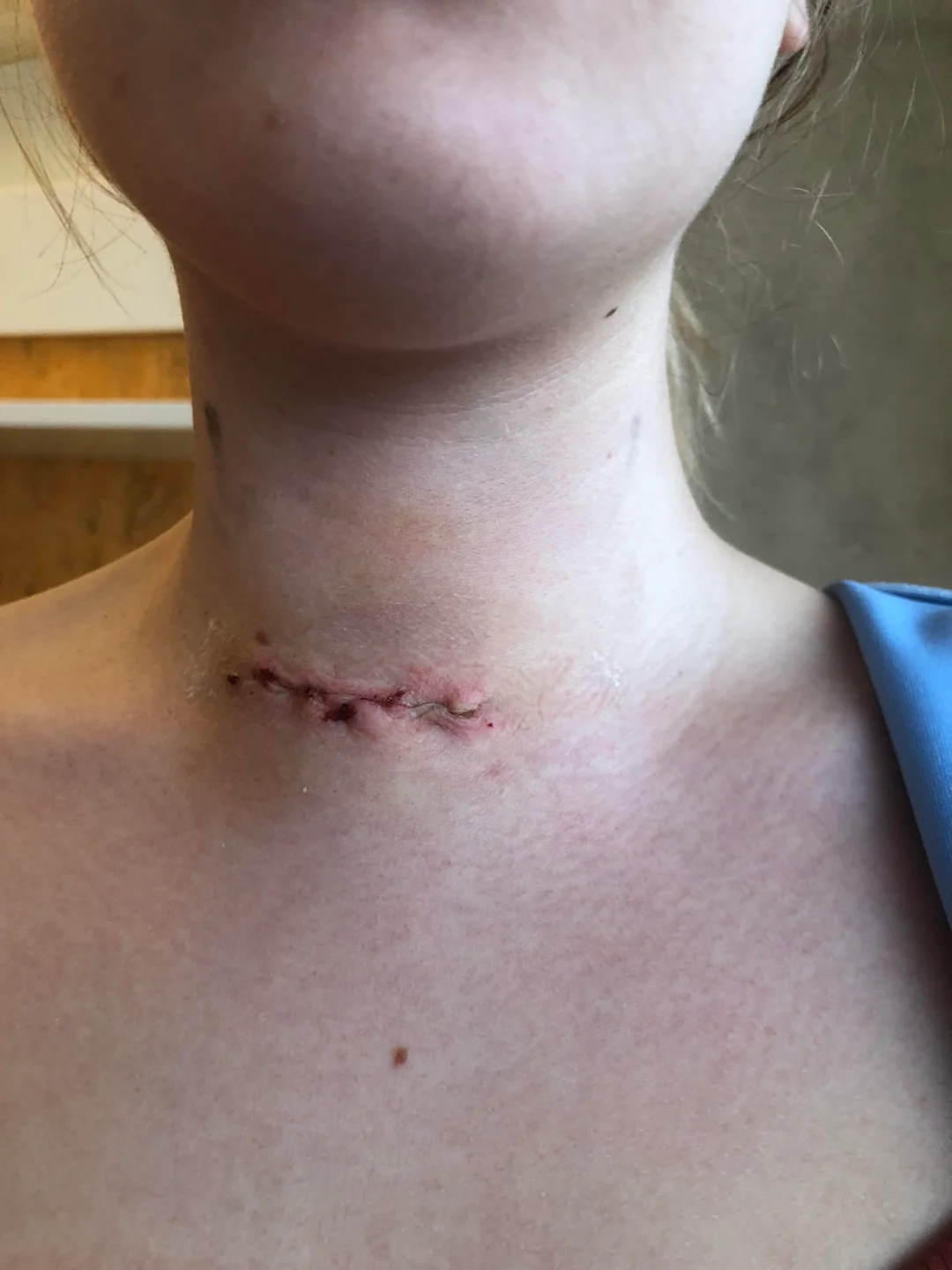 Thyroid Health Daily Facebook ad: Read this if you refused to take GLP-1