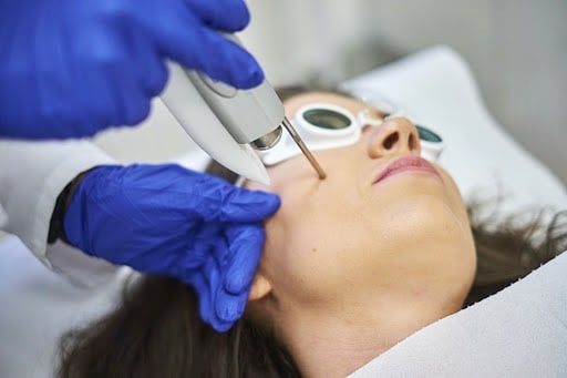 ProClinic Facebook ad: Laserowy lifting skóry FOTONA 4D