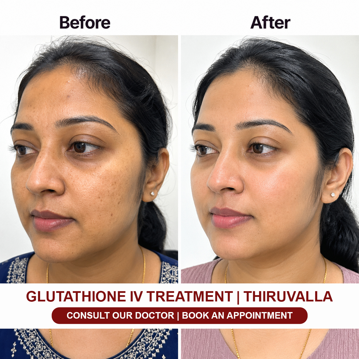Medlounges Aesthetics - Thiruvalla Facebook ad