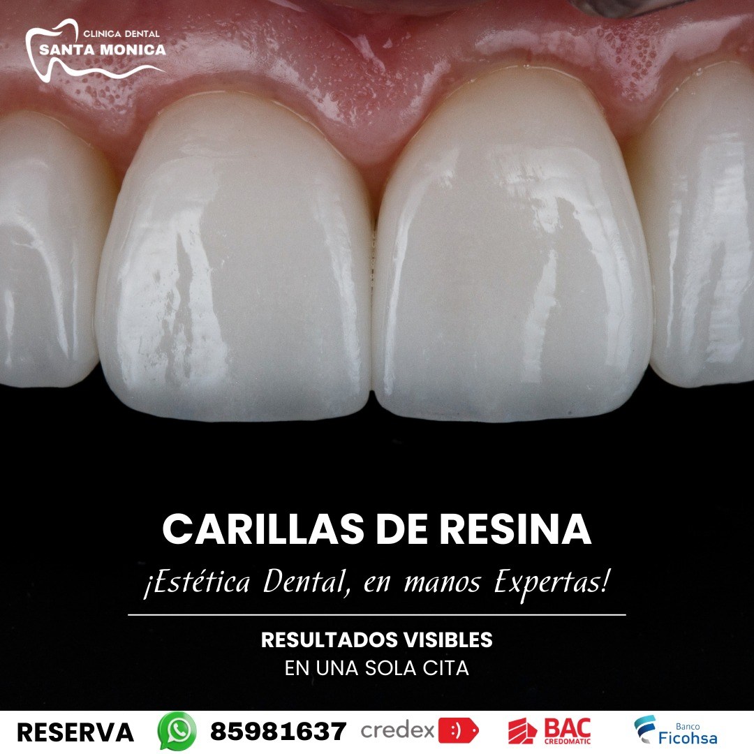 Clinica Dental Santa Monica Facebook ad: Recupera tu sonrisa con carillas de resina estética…