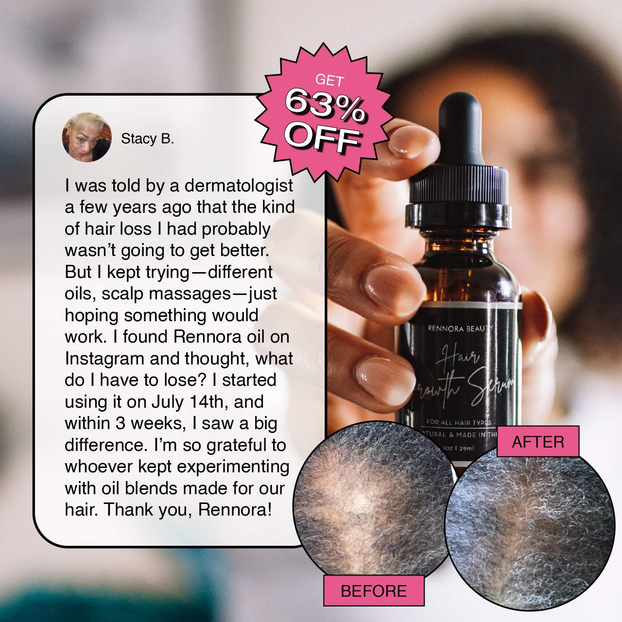 Rennora Beauty Facebook ad