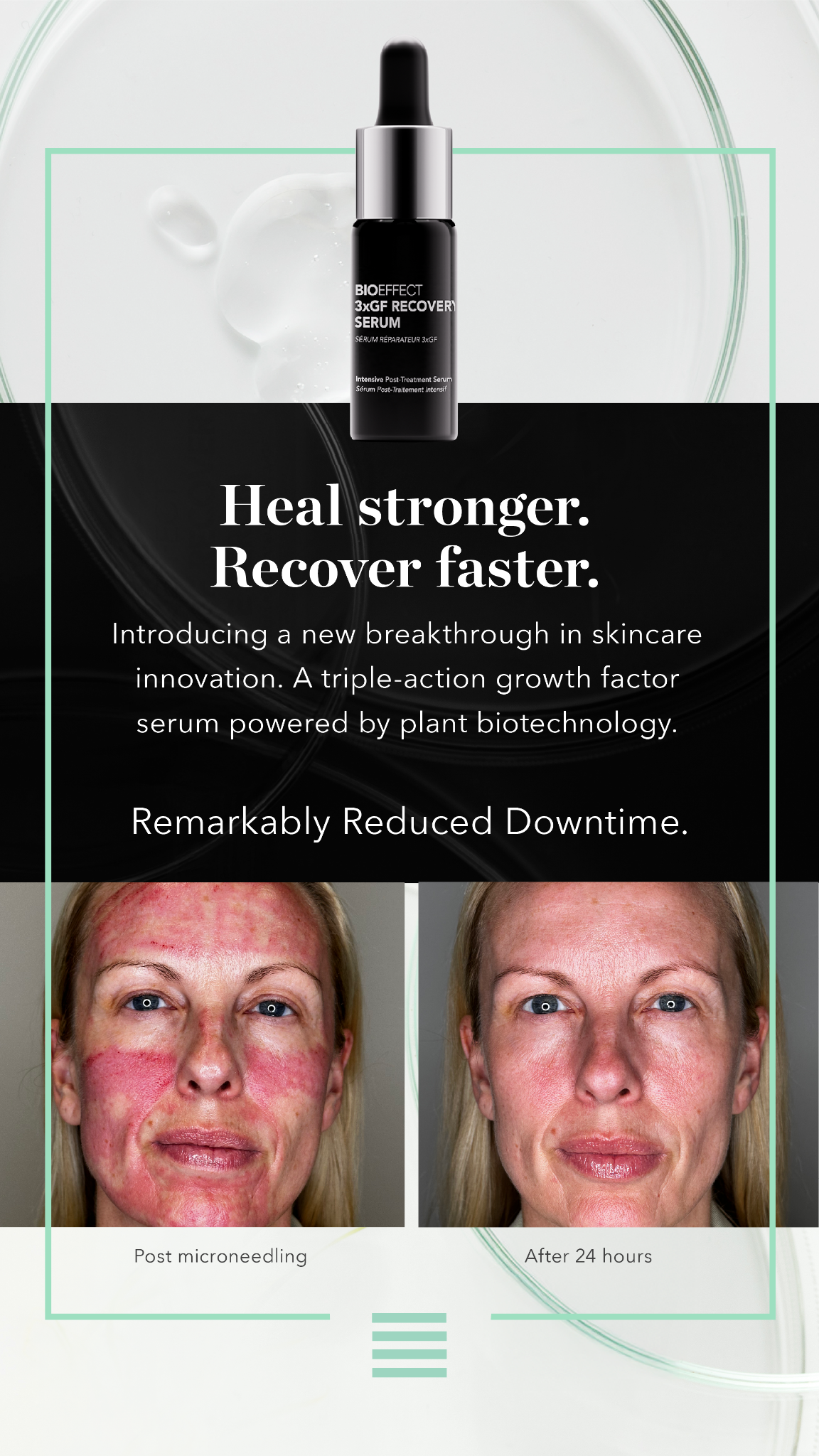 BIOEFFECT Facebook ad