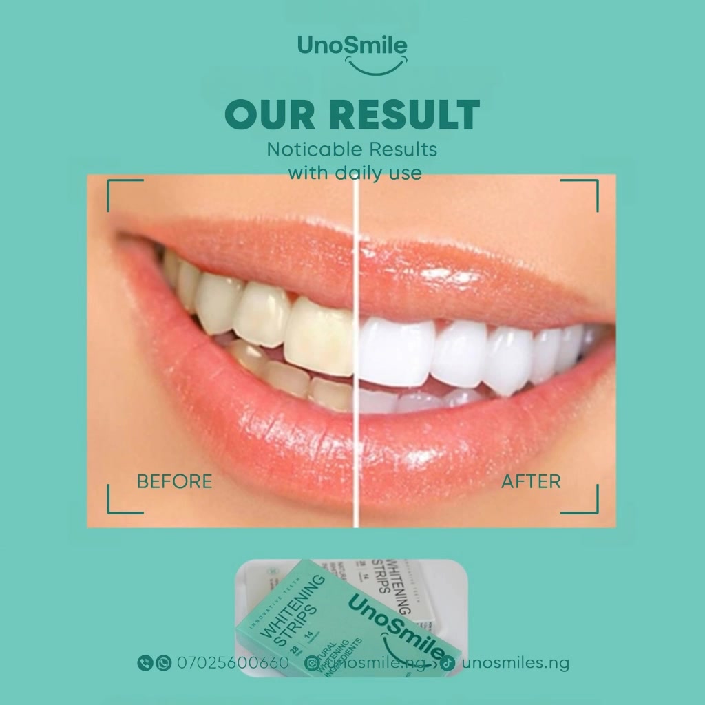 UnoSmile Facebook ad: Why No One Compliments Your Smile