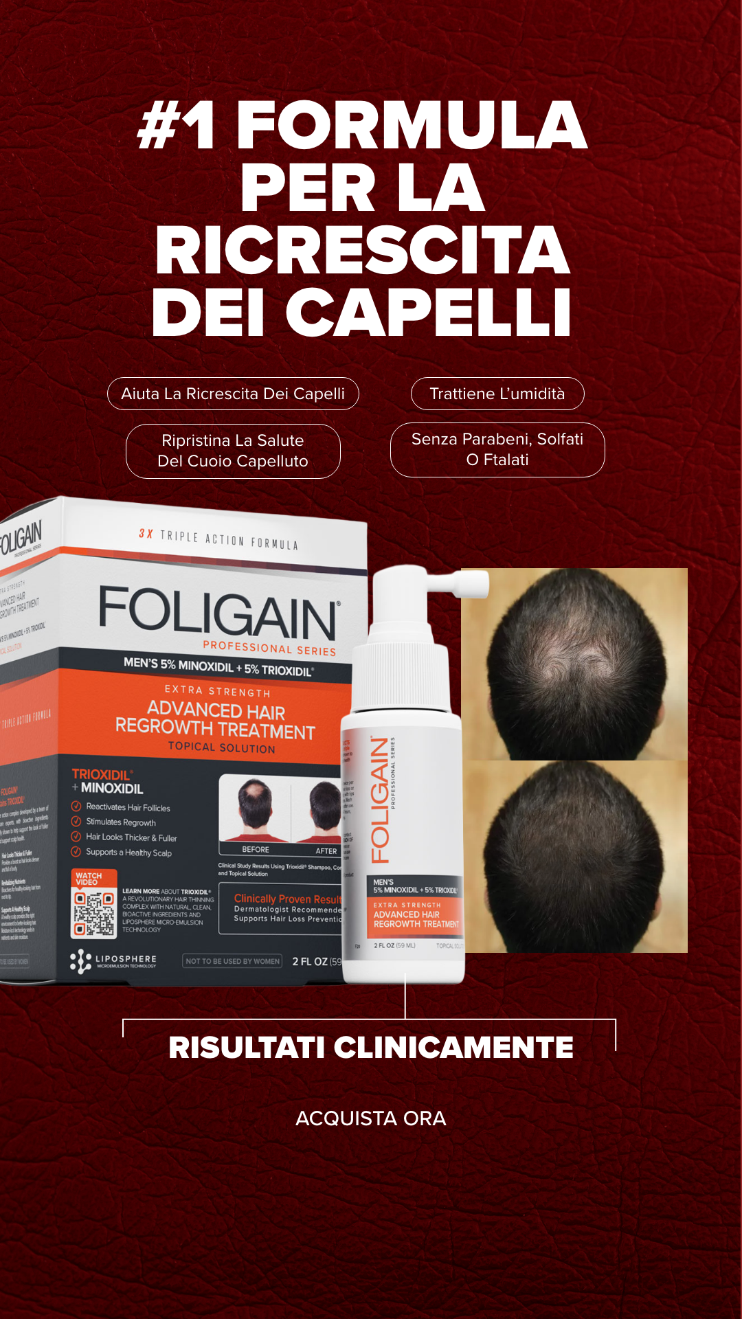 FOLIGAIN Facebook ad