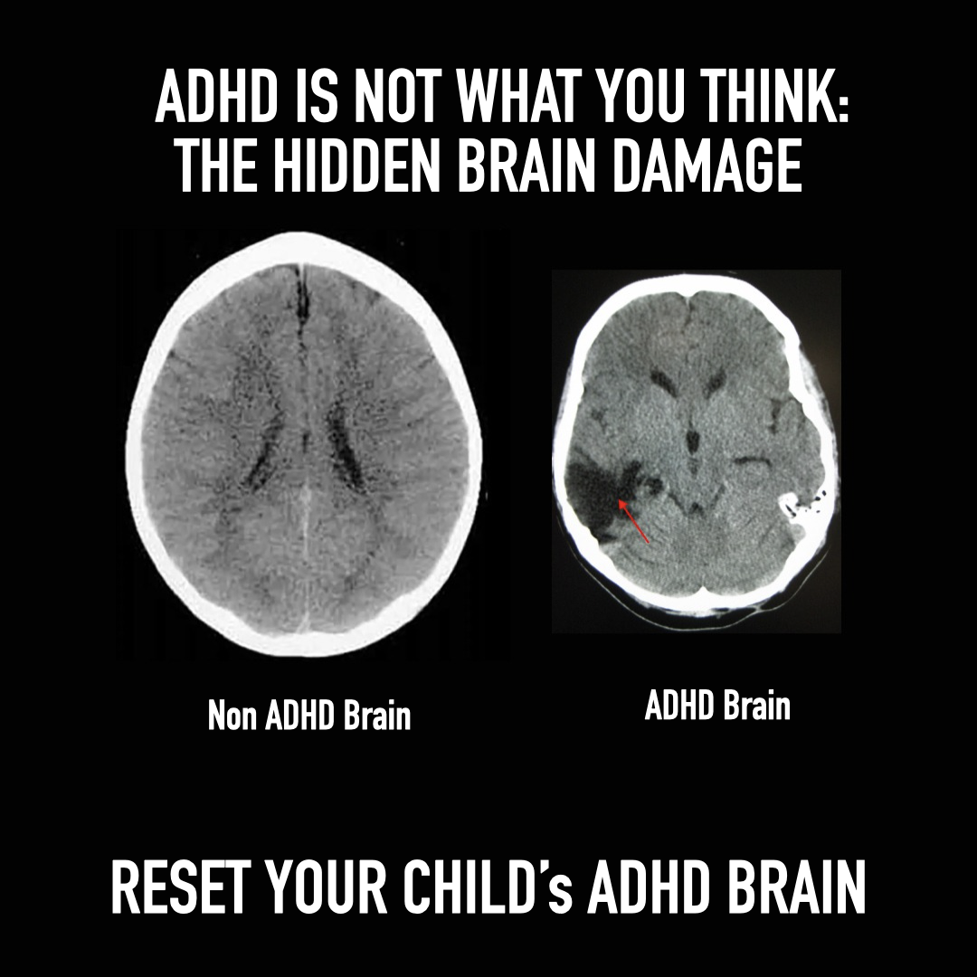 Parenting Pahal Facebook ad: ADHD Parenting? Try these strategies!