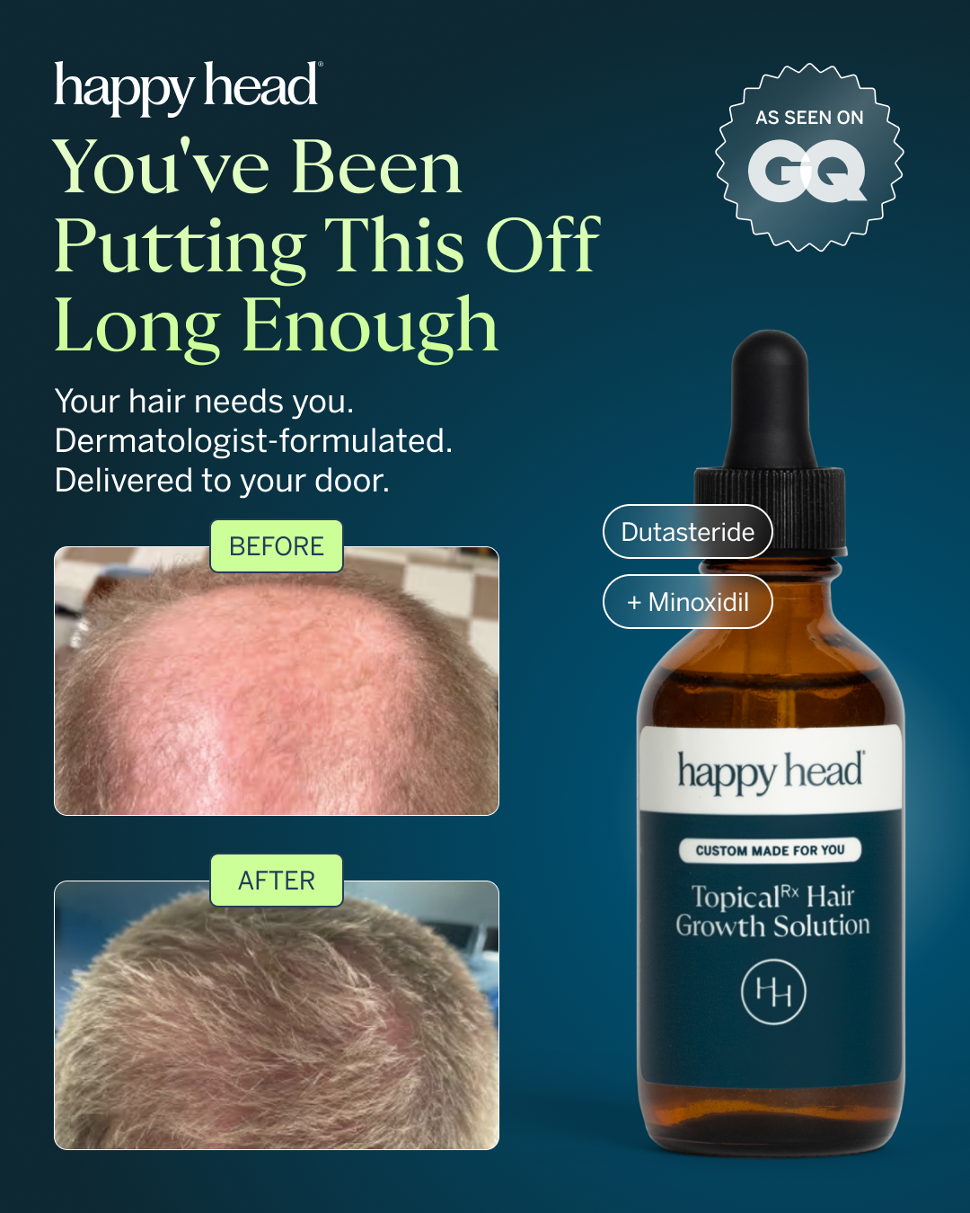 Happy Head Facebook ad: Sign up bonus: First order just $49