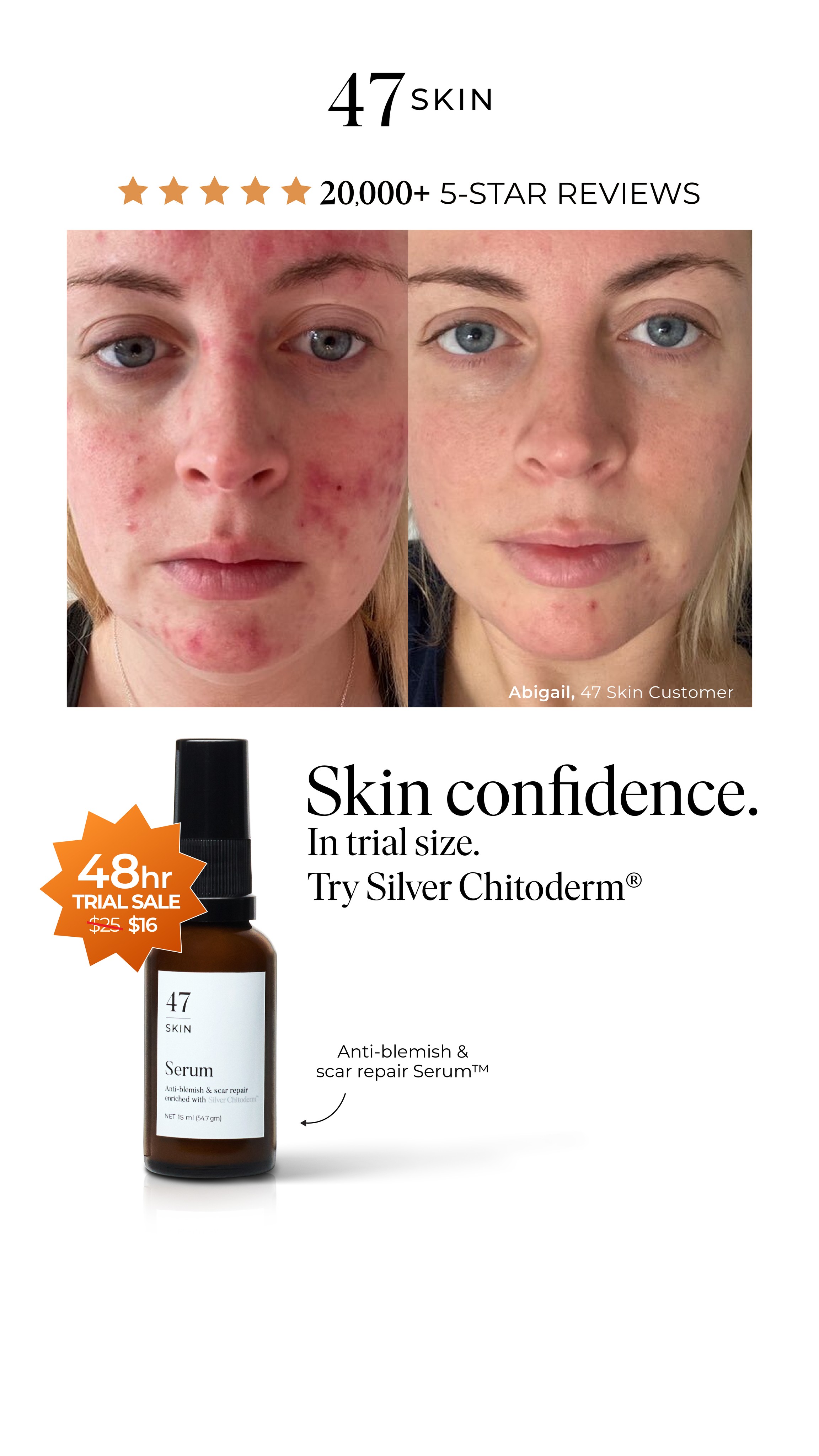 47Skin Facebook ad