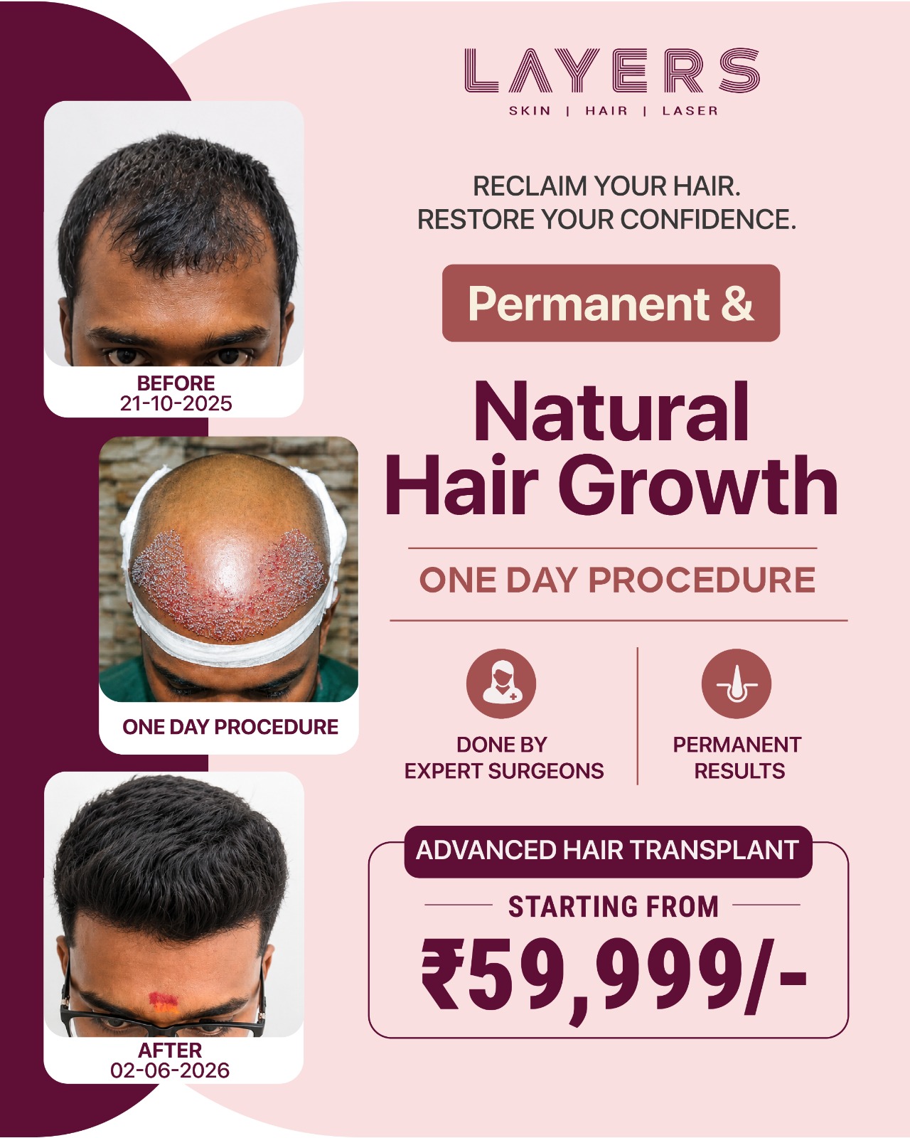 Layers Clinics Facebook ad