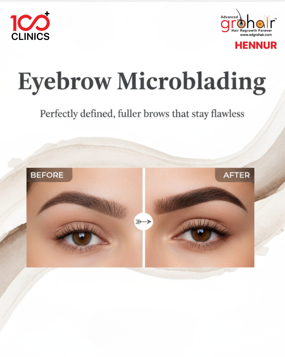 Adgrohair Clinic Hennur Facebook ad