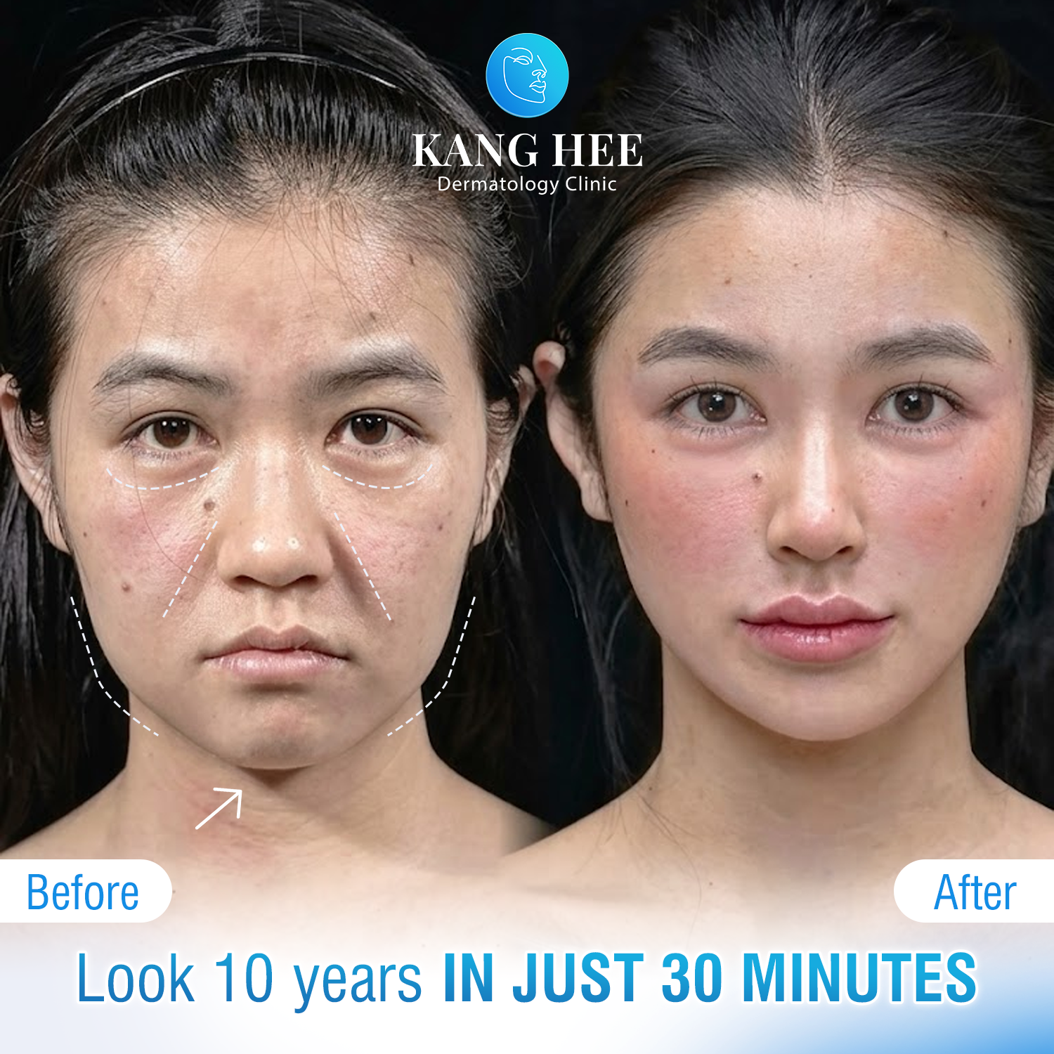 KangHee Royal Aesthetic Clinic Dubai Facebook ad: Enjoy up to 50% OFF