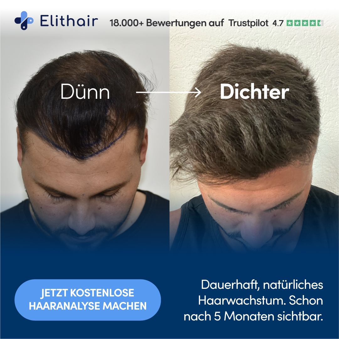 Elithair Facebook ad: Jetzt kostenlose Haaranalyse