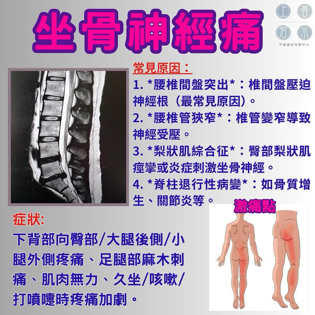 上善若水中醫痛症理療中心 Mercy Chinese Medicine Clinic 筋膜痛症 Chronic Pain Treatment Facebook ad