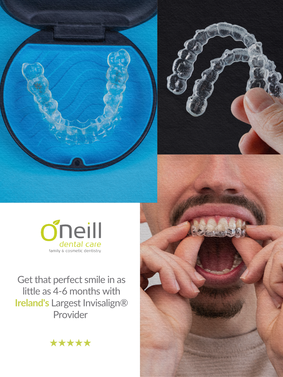 O'Neill Dental Care Swords Facebook ad from Feb 17, 2026