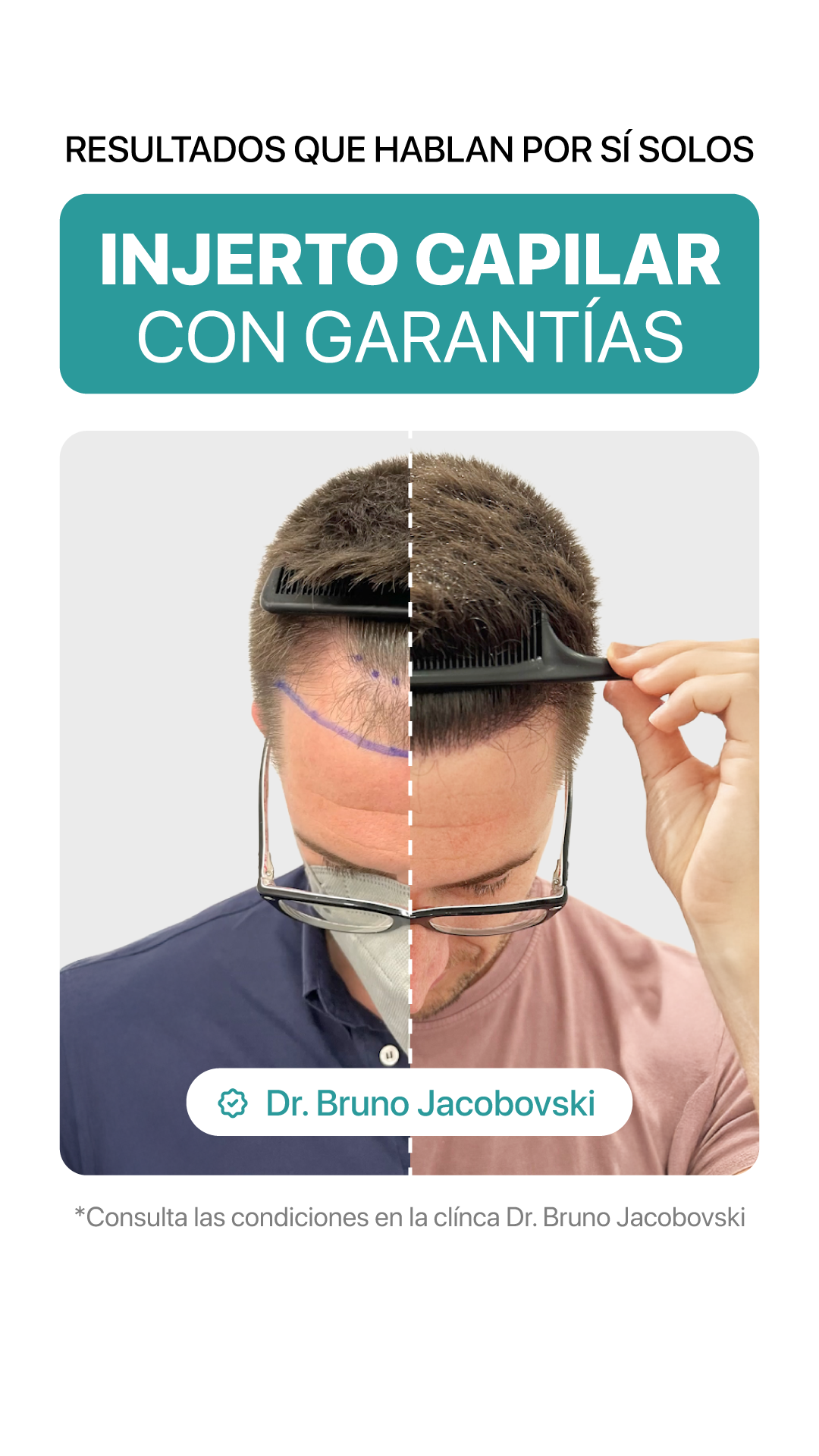 Clínica Jacobovski Facebook ad from Dec 10, 2025