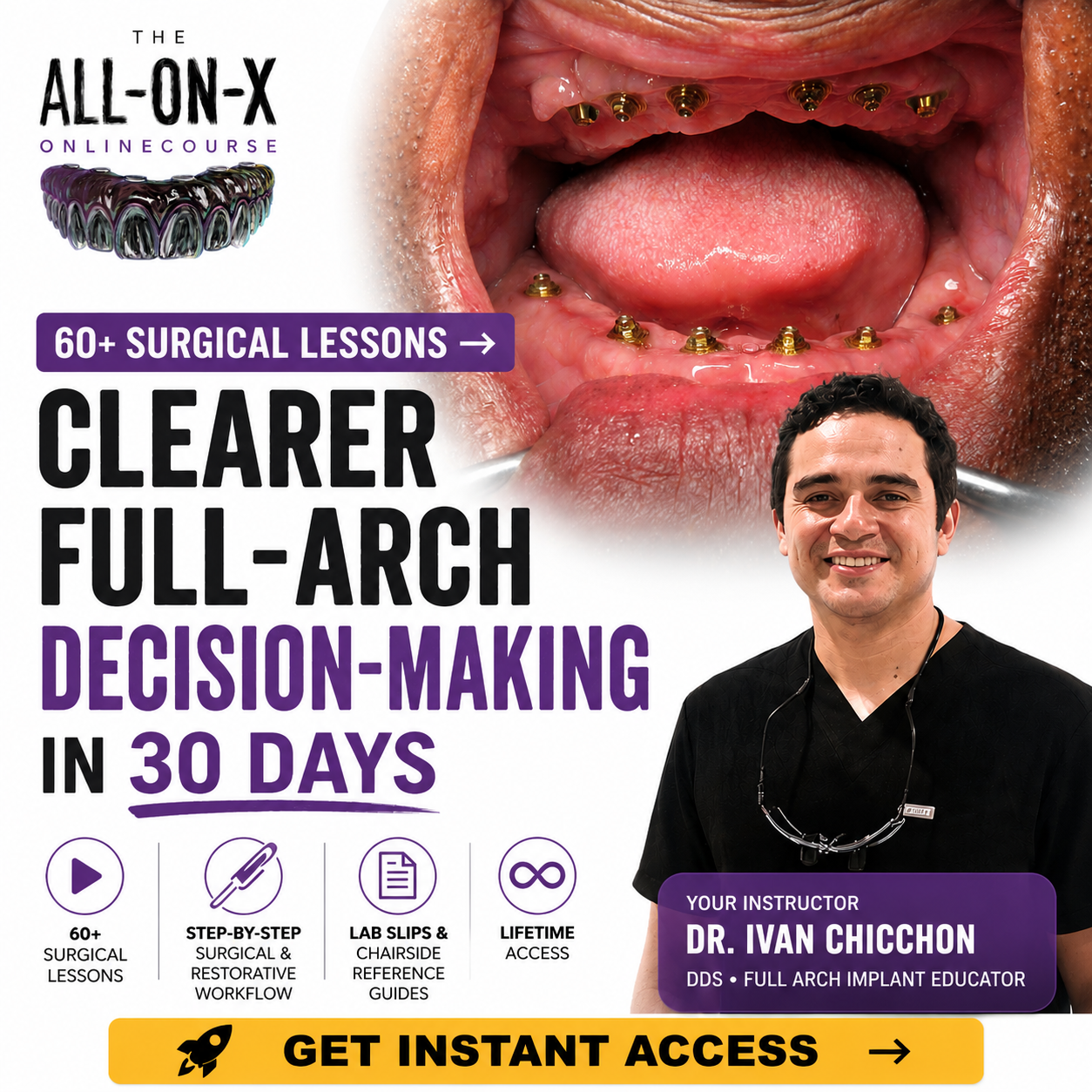 Implant Ninja Education Facebook ad: Clearer Full-Arch Decision-Making