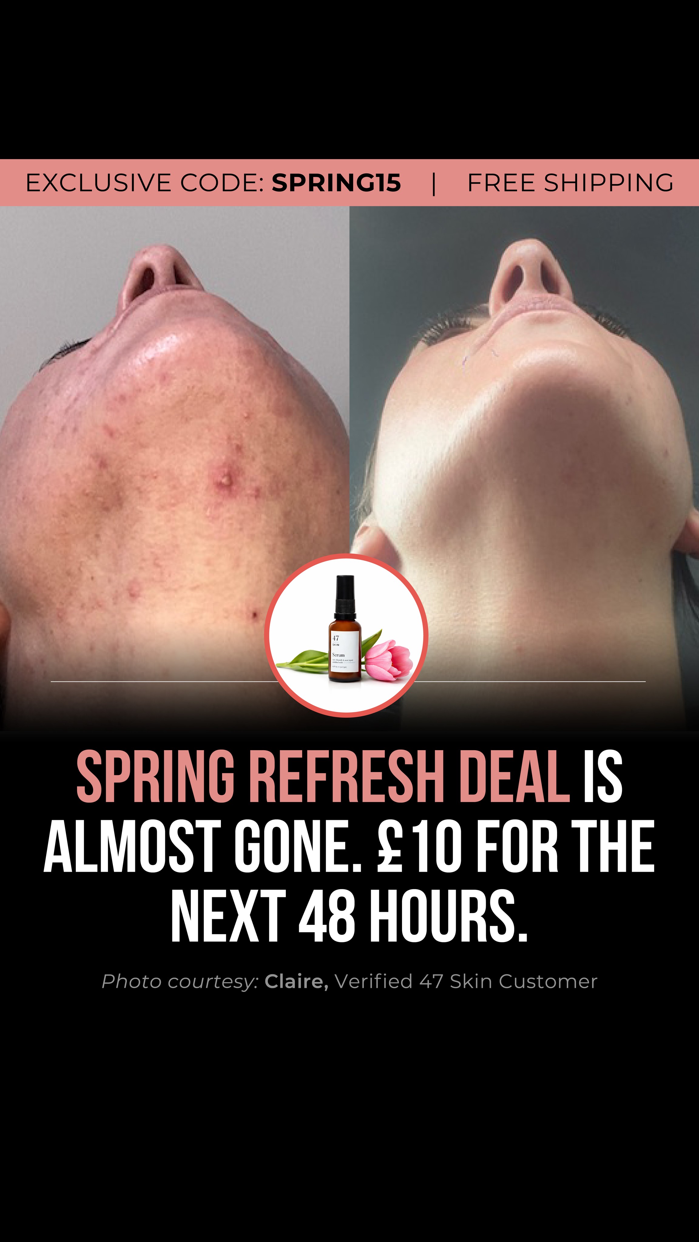47Skin Facebook ad