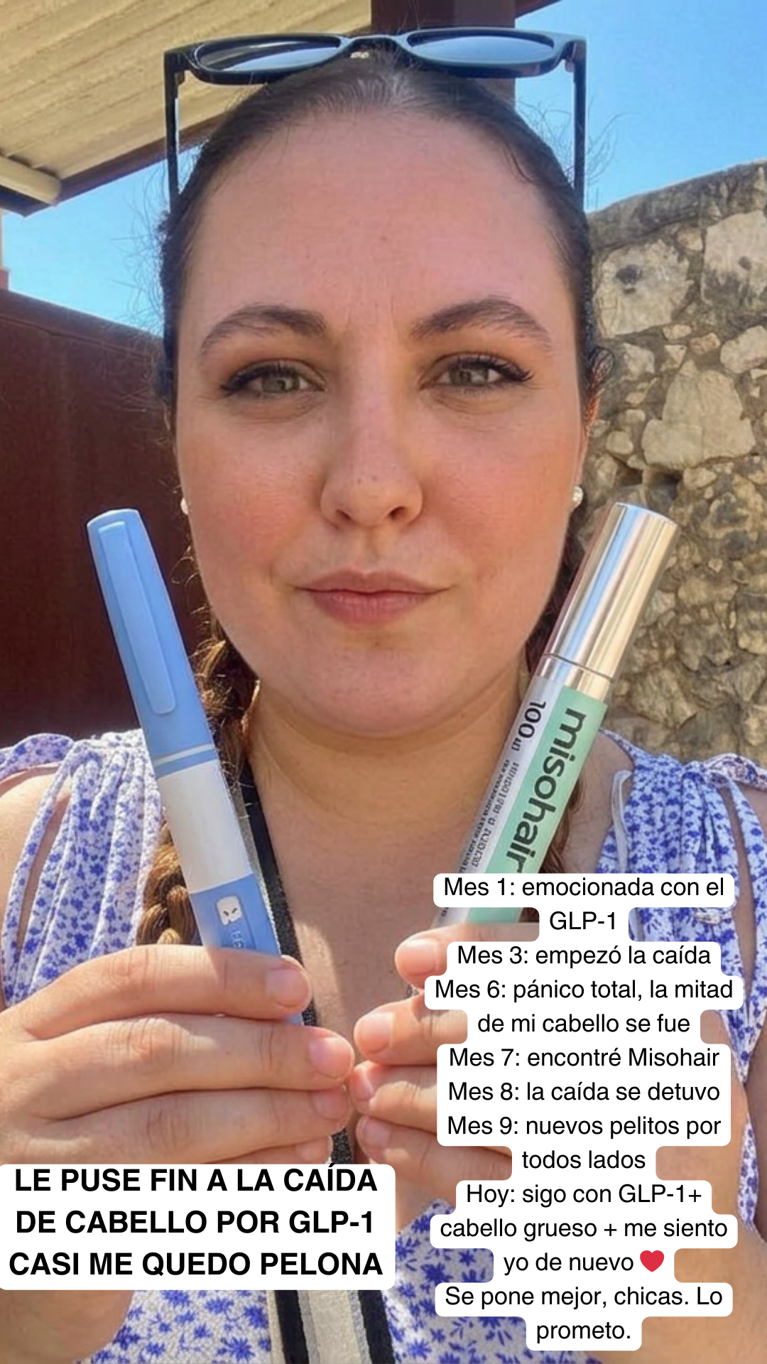 Universidad Maestría Capilar Facebook ad: Mes 3 de Ozempic. Me senté en el suelo de la ducha a…