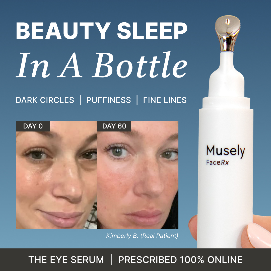 Musely Facebook ad