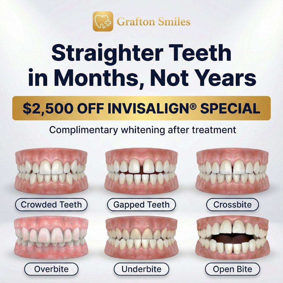 Graftonsmiles Facebook ad: Grafton Invisalign Special, Save $2,500 (Only 12 Vouchers)