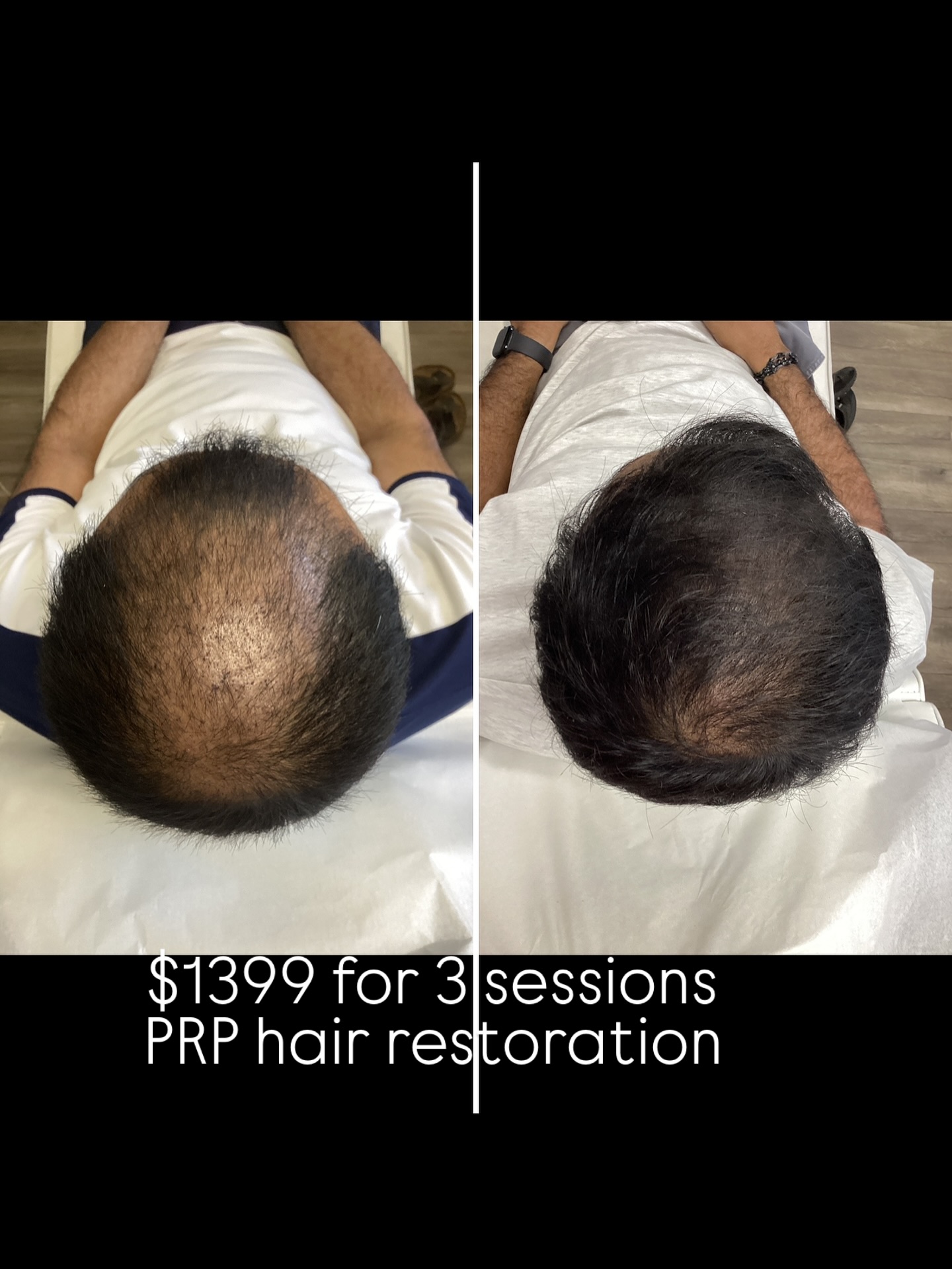 Radiant Med Spa Facebook ad