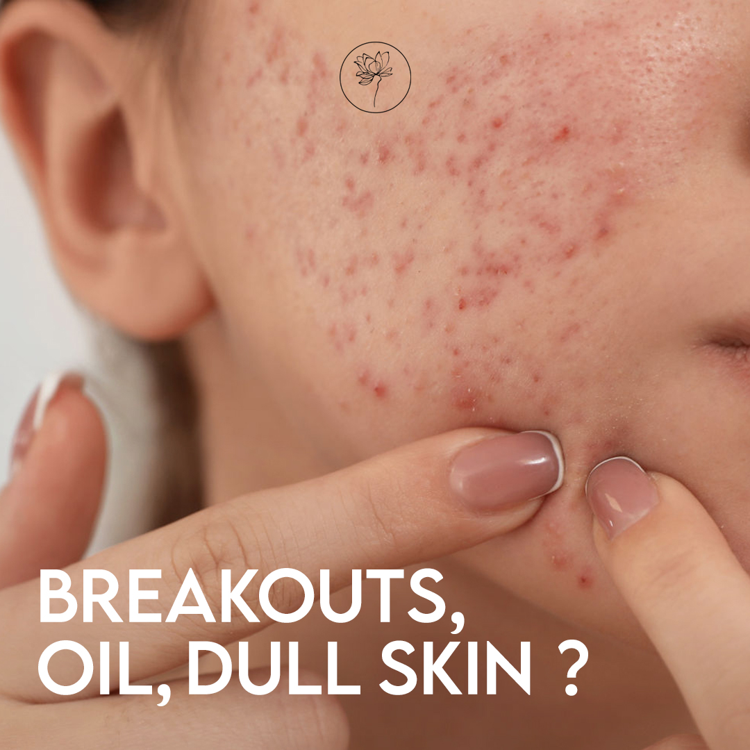 Blissful Beauty  Facebook ad